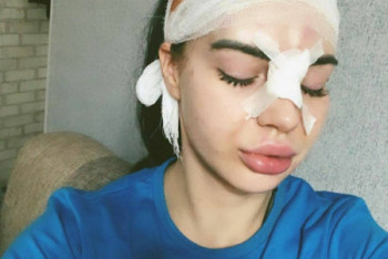 Фотография к новости: Рухнувший прожектор причинил переломы позвонков и травмы девушкам в ночном клубе в Караганде