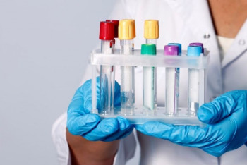 Фотография к новости: Когда будут проводить экспресс-тесты на коронавирус в Нур-Султане