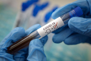 Фотография к новости: Госслужащие оказались в числе зараженных COVID-19 в Петропавловске