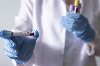 Фотография к новости: 19 зараженных COVID-19 в Акмолинской области контактировали с умершим постояльцем дома престарелых