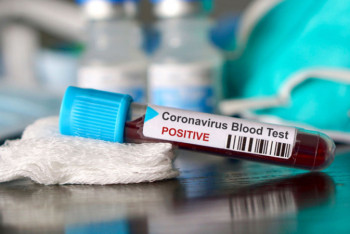 Фотография к новости: ВОЗ просит казахстанцев не пугаться резкого увеличения статистики по COVID-19