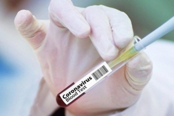 Фотография к новости: О "подушке безопасности" в случае второй волны КВИ рассказал Цой