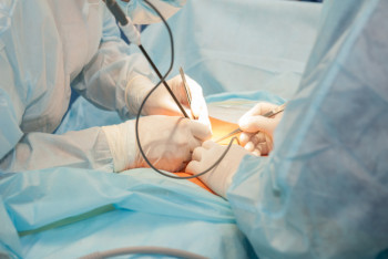 Фотография к новости: Десять тысяч дорогих операций провели за счет ОСМС в 2020 году