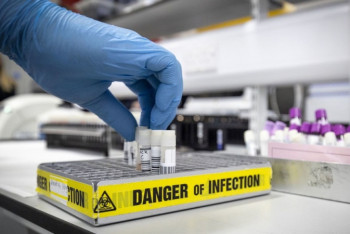 Фотография к новости: Информацию об "алматинском" штамме коронавируса прокомментировал Бекшин