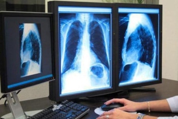 Фотография к новости: Десять человек скончались от туберкулёза в Кызылординской области