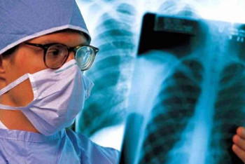 Фотография к новости: Как уберечь себя от туберкулёза и отличить его от гриппа, рассказал эксперт