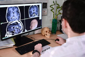 Фотография к новости: Какие шампуни могут вызвать рак, рассказал онколог