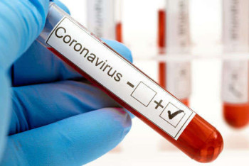 Фотография к новости: 73 казахстанца заразились коронавирусом за сутки