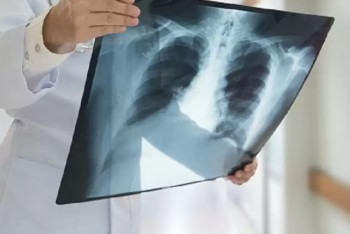 Фотография к новости: В Шымкенте педагог с открытой формой туберкулеза вела уроки в школе