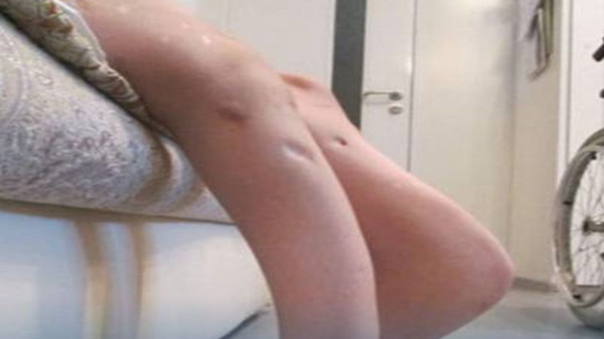  пресс-служба Минздрава РК