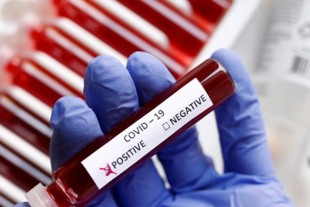 Фотография к новости: За сутки коронавирусом заразился 61 казахстанец