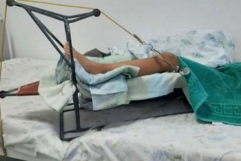 Фотография к новости: Шкаф упал на девочку в школе Кызылорды: ребёнок находится в тяжёлом состоянии