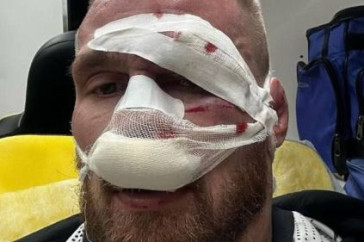 Фотография к новости: Бойца из Казахстана госпитализировали после кровавого нокаута в Сочи