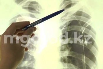 Фотография к новости: В Уральске выросла заболеваемость туберкулёзом среди детей