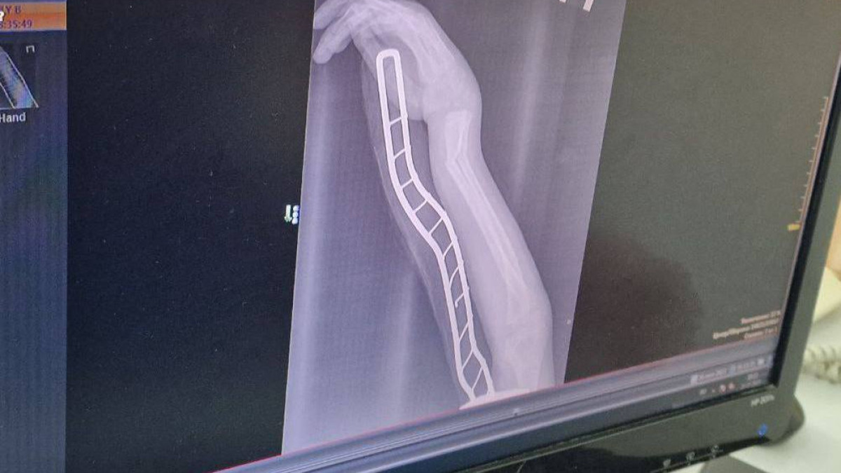  Гульнара Джусупова