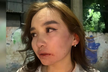 Фотография к новости: В Алматы парень жестоко избил девушку за отказ познакомиться