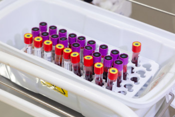 Фотография к новости: Карагандинец умышленно заражал женщин ВИЧ