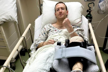 Фотография к новости: Цукербергу сделали срочную операцию