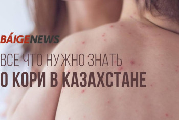 Фотография к новости: Эксперт дал прогноз по ситуации с корью в Казахстане