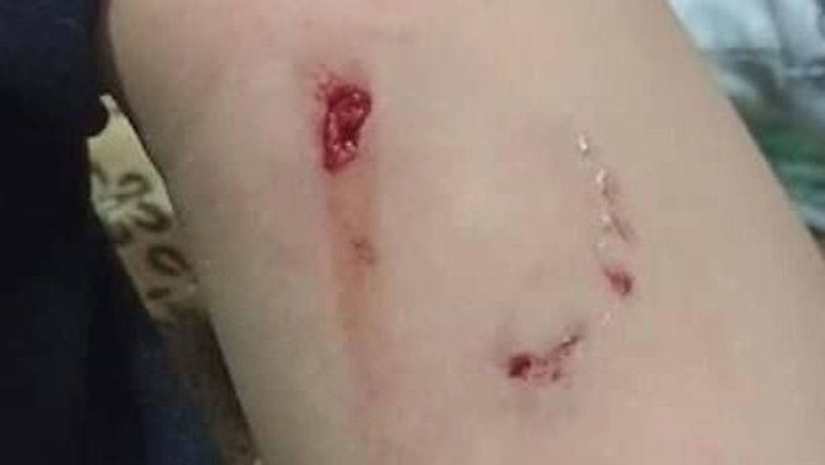  instagram.com/ablaketka_novosti