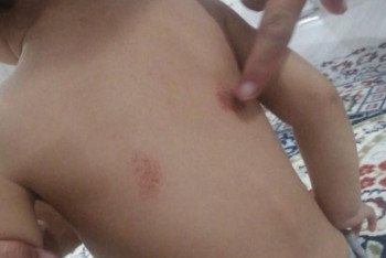 Фотография к новости: Все детские сады Актобе должны быть обрадованы видеонаблюдением – аким