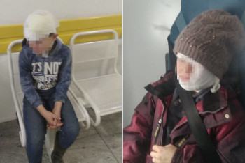 Фотография к новости: Остались со шрамами на лице: соседская собака покусала детей в ВКО