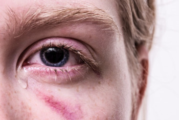 Фотография к новости: Как запах женских слёз влияет на поведение мужчин — исследование