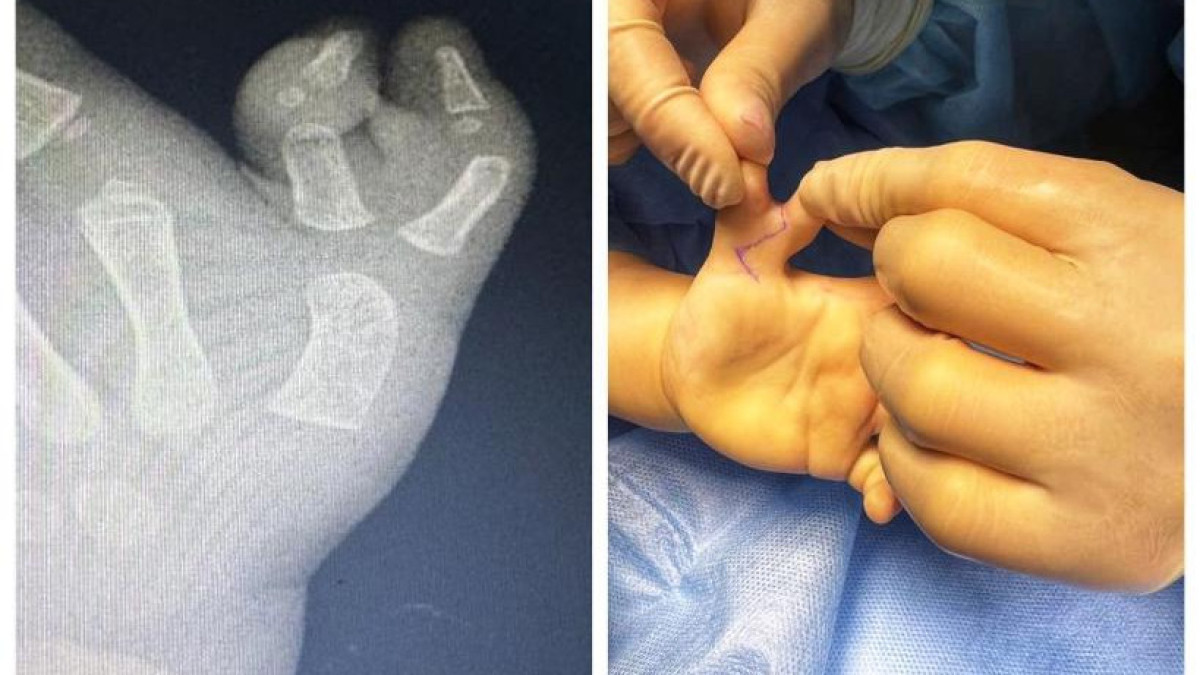  управление общественного здравоохранения Алматы