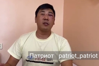 Фотография к новости: Избитый в Караганде водитель скорой помощи подал иск