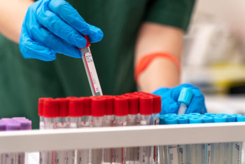 Фотография к новости: Два случая бруцеллеза выявили у жителей Костанайской области