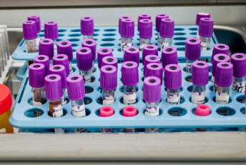 Фотография к новости: Две бразильянки стали первыми в мире жертвами лихорадки Оропуш