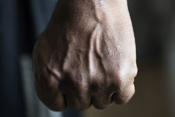 Фотография к новости: Сжег бровь, сломал плечо: мужчина устроил самосуд над школьником