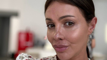 Фотография к новости: Пластический хирург показал восстановленный нос бывшей жены Аршавина