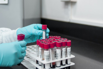 Фотография к новости: Диагноз сибирская язва подтвердился у 11 жителей Алматинской области