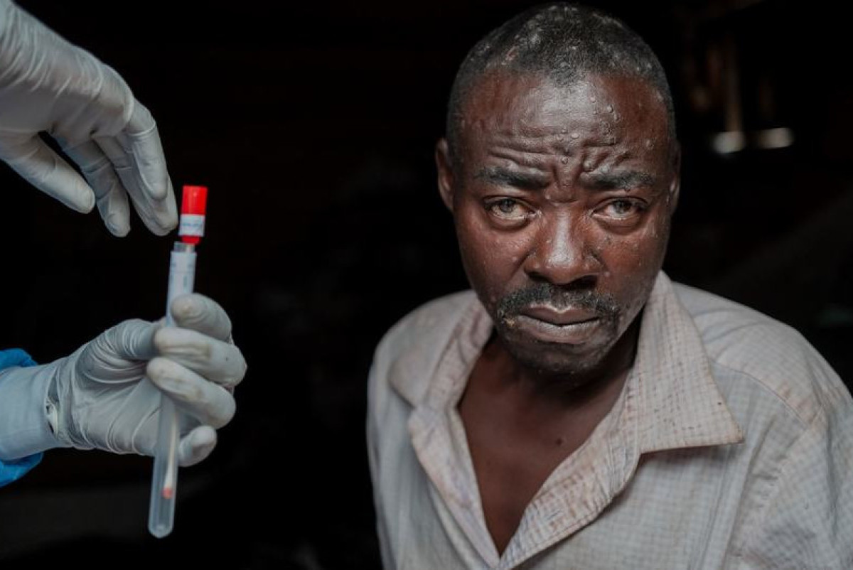  ВОЗ / Г.Ндебо