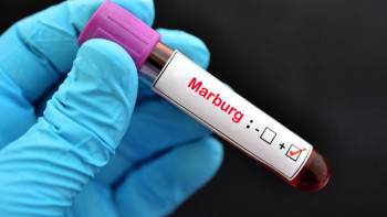 Фотография к новости: Минздрав усиливает контроль из-за угрозы новой опасной инфекции