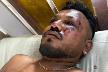 Фотография к новости: "Вокруг были тела": один человек выжил в авиакатастрофе в Индии