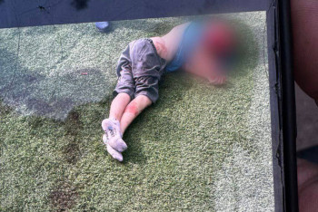 Фотография к новости: Бойцовские собаки напали на 10-летнего мальчика под Алматы и откусили ему ухо