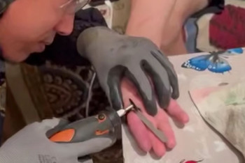 Фотография к новости: Спасатели помогли жителю области Улытау  снять застрявшее на пальце кольцо