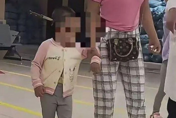 Фотография к новости: В Китае врачи спасли девочку с ножом в голове