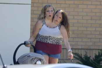 Фотография к новости: Сиамские близнецы Эбби и Бриттани стали мамами — СМИ