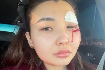 Фотография к новости: "Меня обманули и унизили": блогера из Атырау вывезли за город и избили