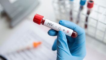 Фотография к новости: ВИЧ в Казахстане: где живёт больше всего носителей инфекции - свежая статистика от Минздрава