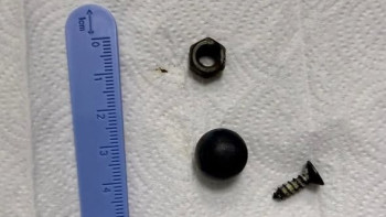 Фотография к новости: Врачи извлекли магнит и металлические предметы из кишечника ребенка в Шымкенте