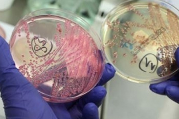 В Астане госпитализирован мужчина с подозрением на менингококковую инфекцию