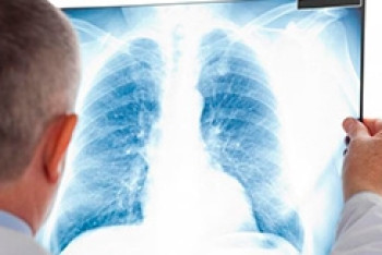 У воспитателя детского сада в Шортандинском районе выявлен туберкулез