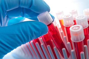 Фотография к новости: Увеличение пятилетной выживаемости до 60% прогнозируют гематологи Казахстана 