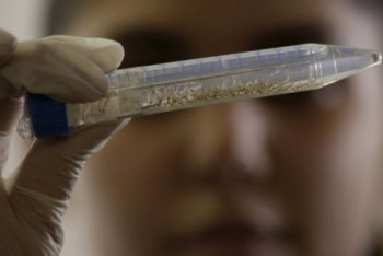 Фотография к новости: Казахстанцы стали реже болеть дизентерией – Минздрав