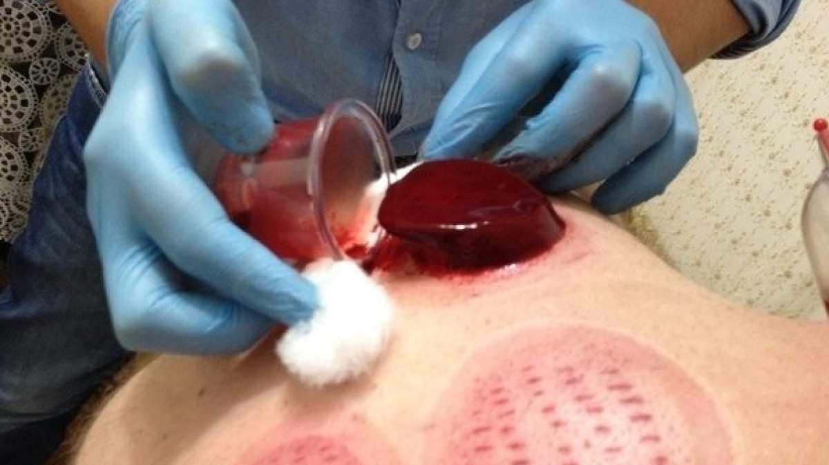 открытые источники