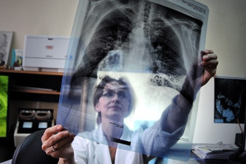 Фотография к новости: Более 44 тысяч мигрантов обследованы в Казахстане на туберкулёз за три года